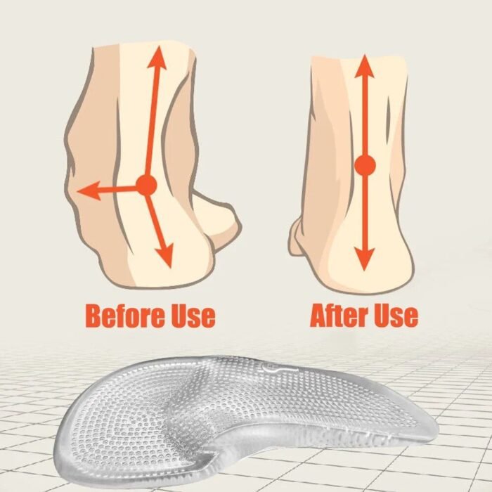 Comfort Gel Orthopedic Insoles - Arch Support for Flat Feet & Plantar Fasciitis Relief - Image 5